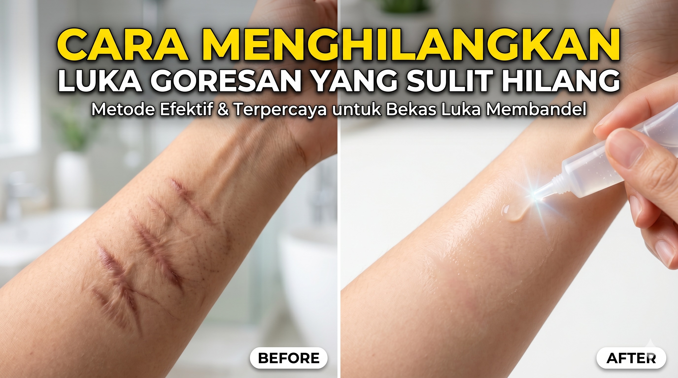 Cara Menghilangkan Luka Goresan Yang Tidak Bisa Hilang